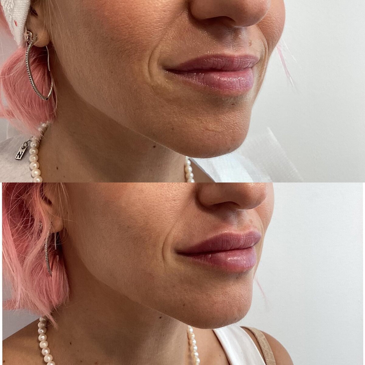 יפה מקסימוב - עיצוב שפתיים 