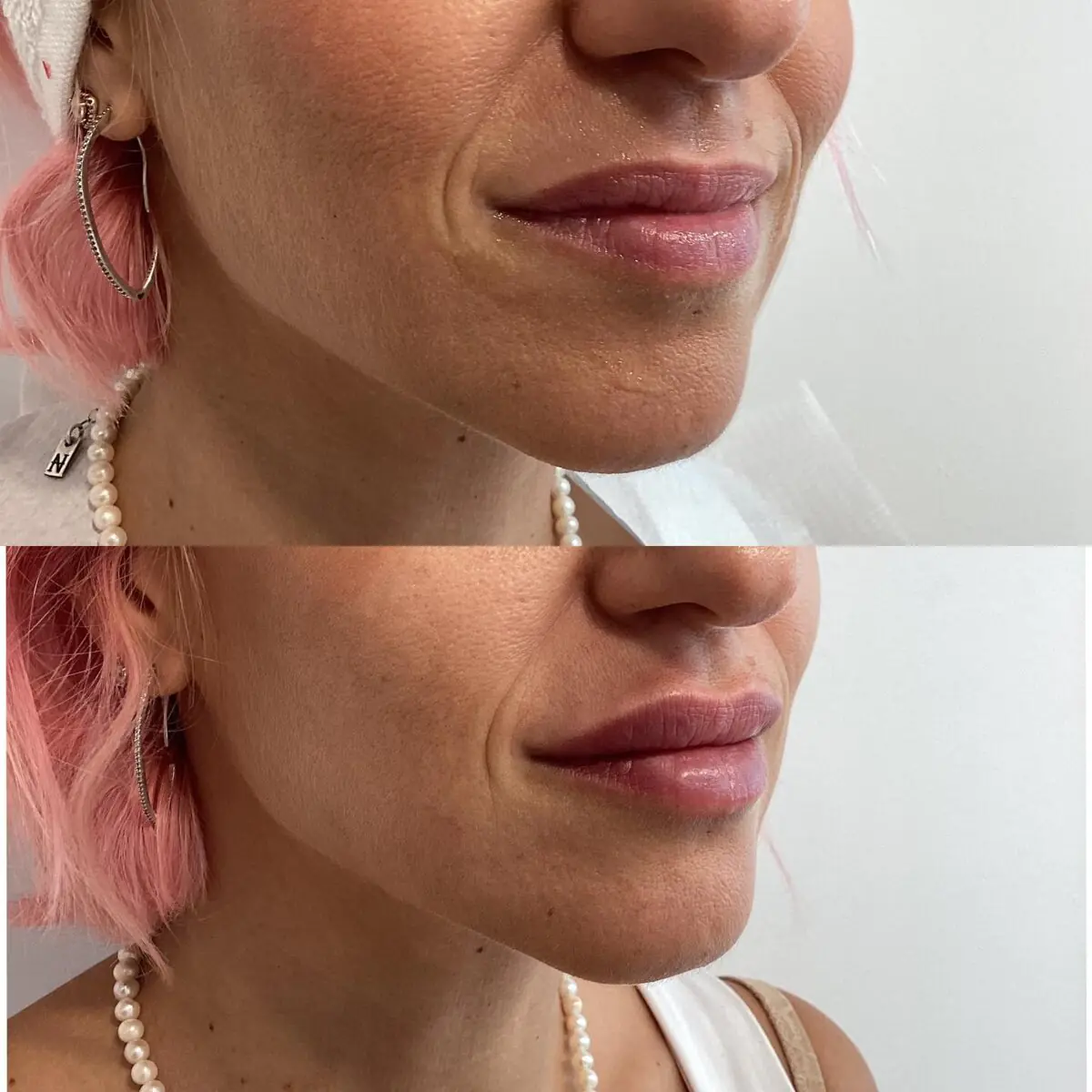 יפה מקסימוב - עיצוב שפתיים 