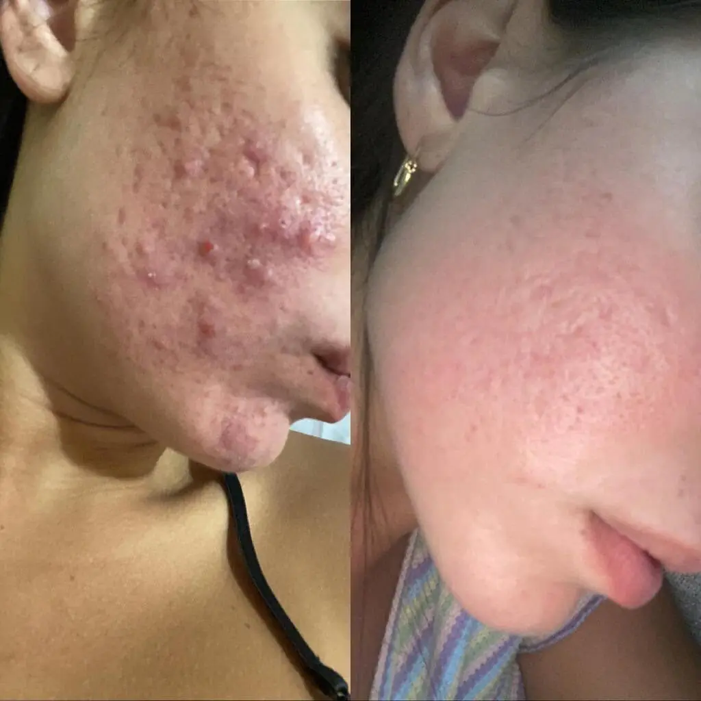 יפה מקסימוב - עיצוב שפתיים 